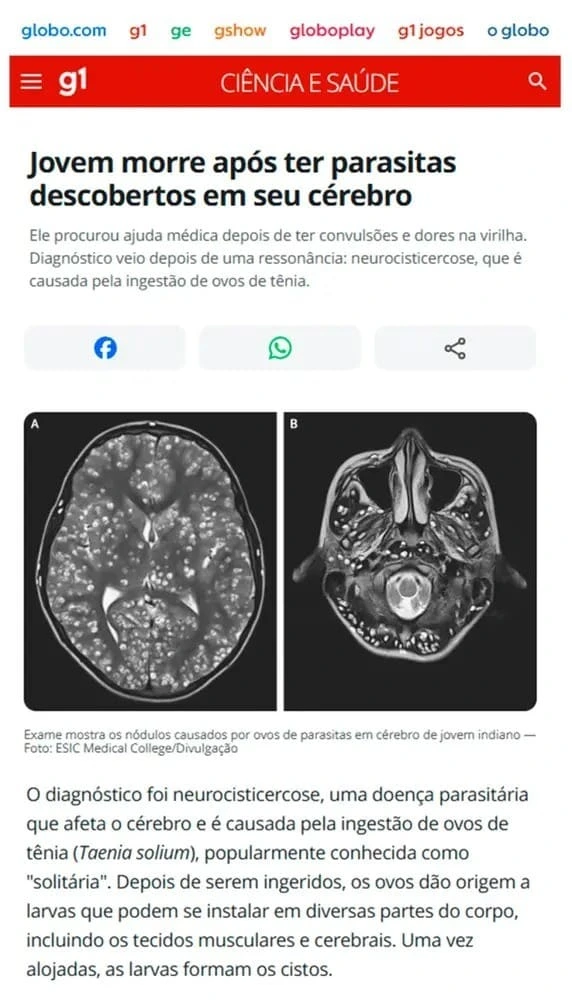 Exame de Imagem
